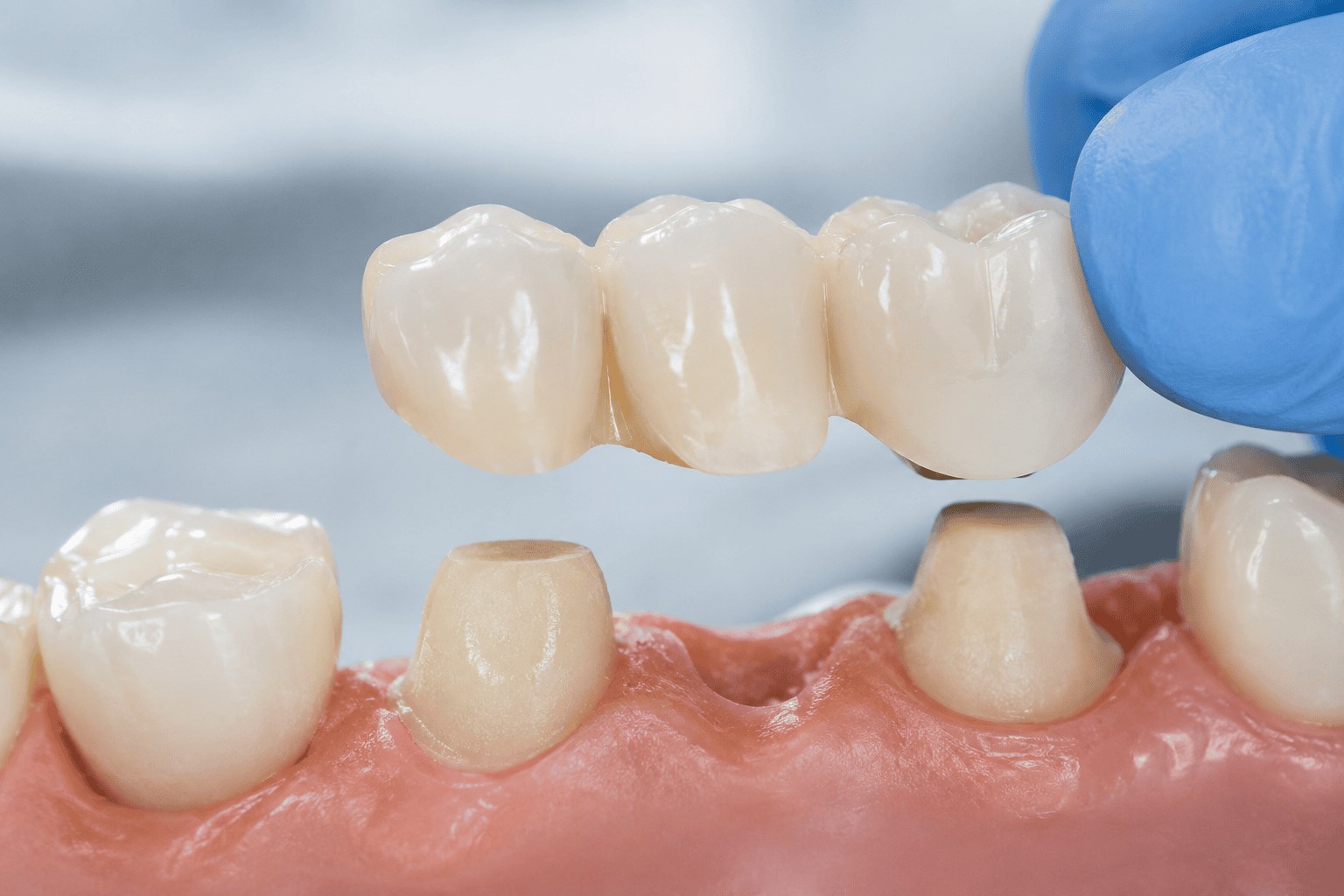 VP Dental Clinic Dental Prosthodontics-Fixed Services